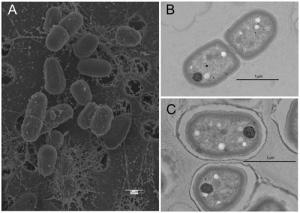 Scanning electron micrograph of Gloeobacter kilaueensis