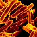 Tuberculosis could be eradicated in 26 years, public health report says