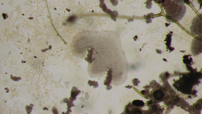 Microscopic view of Trichoplax
